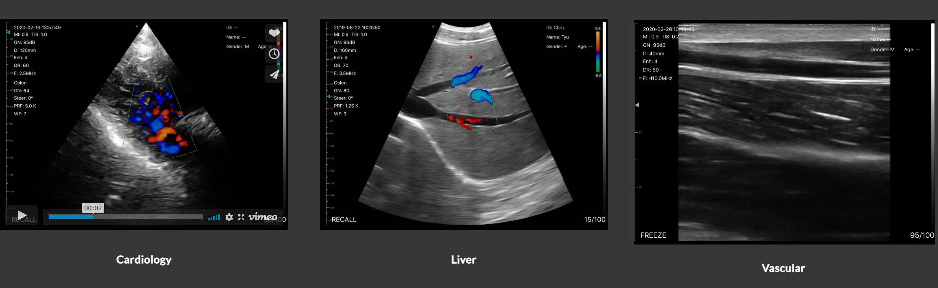 Wellue Health Offer New Arrival Designed To Make Ultrasound Easy To Use Offer Emails