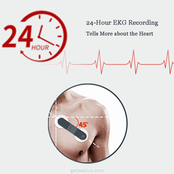 Wellue Blood Pressure/EKG Monitor review - Keep calm but monitor on - The  Gadgeteer