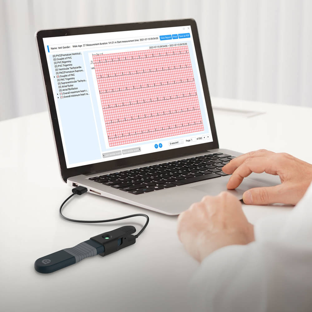 AI analyzed ECG reports