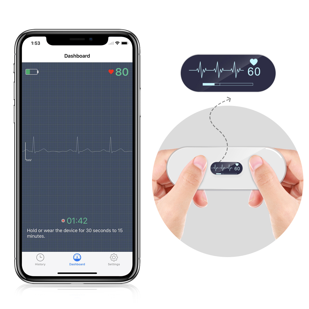 Wellue 12-Lead Holter Monitor with AI Analysis - 24-Hour Holter Monitoring  with AI report